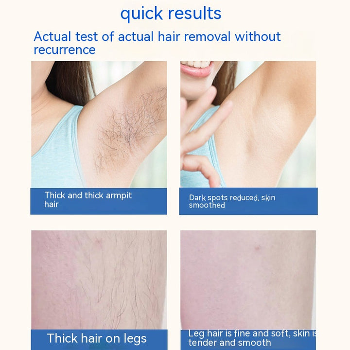 Household Whole Body Painless Laser Hair Removal Device
